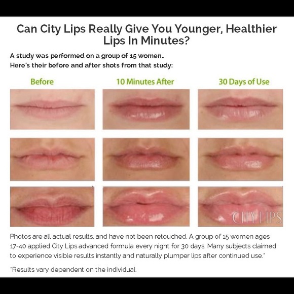 plumper Makeup City Lips Lip Plumper Poshmark